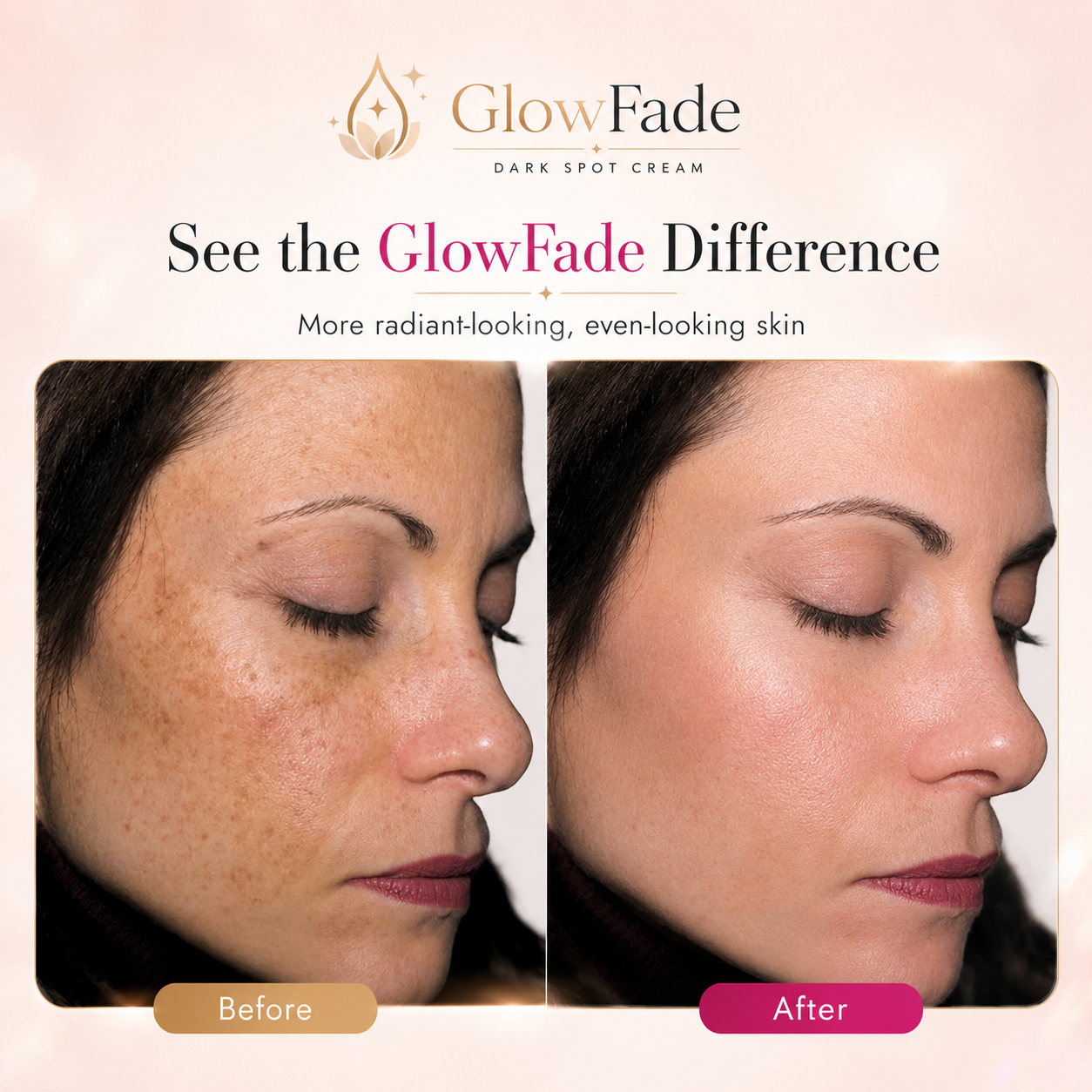 GlowFade Arbutin 7% + TXA 4% Dark Spot Cream