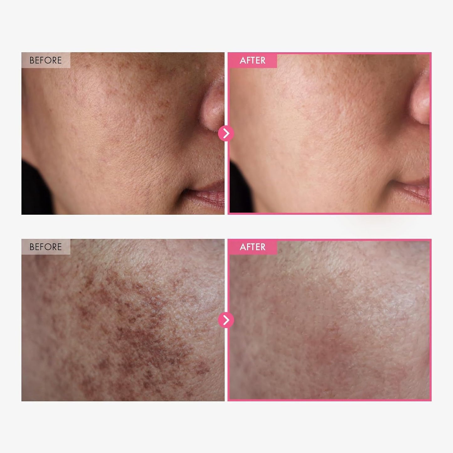 GlowFade Arbutin 7% + TXA 4% Dark Spot Cream